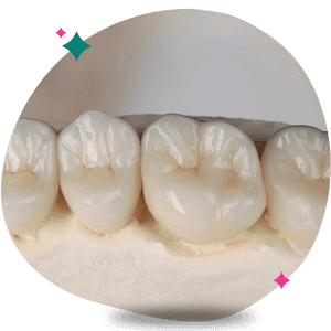 Zirconia Crowns